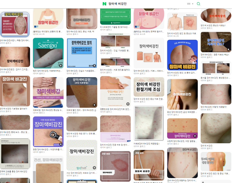 장미색 비강진 화곡동 이목한의원