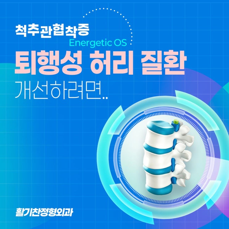 은평구척추관협착증 퇴행성 허리 질환 개선하려면