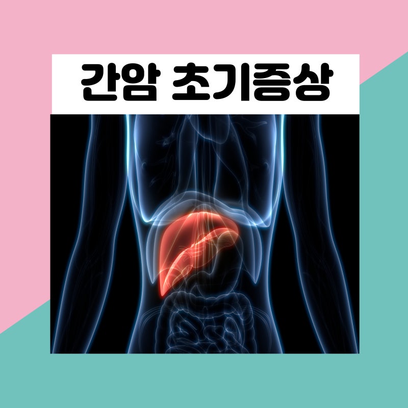 간암 증세 초기증상 말기 생존율 정리