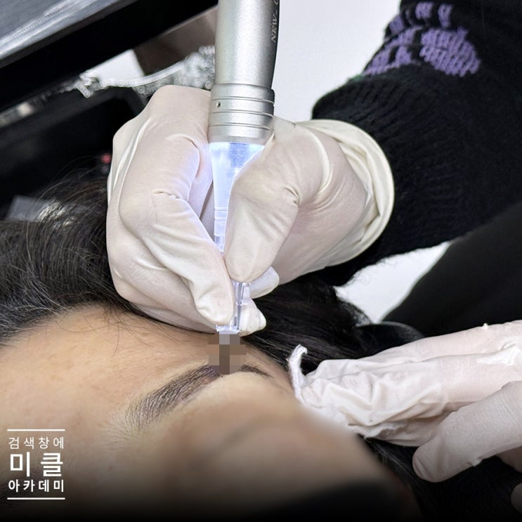  반영구머신 니들의 종류와 형태 이해하기