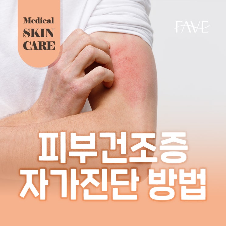  피부 건조증 증상 자가진단 방법