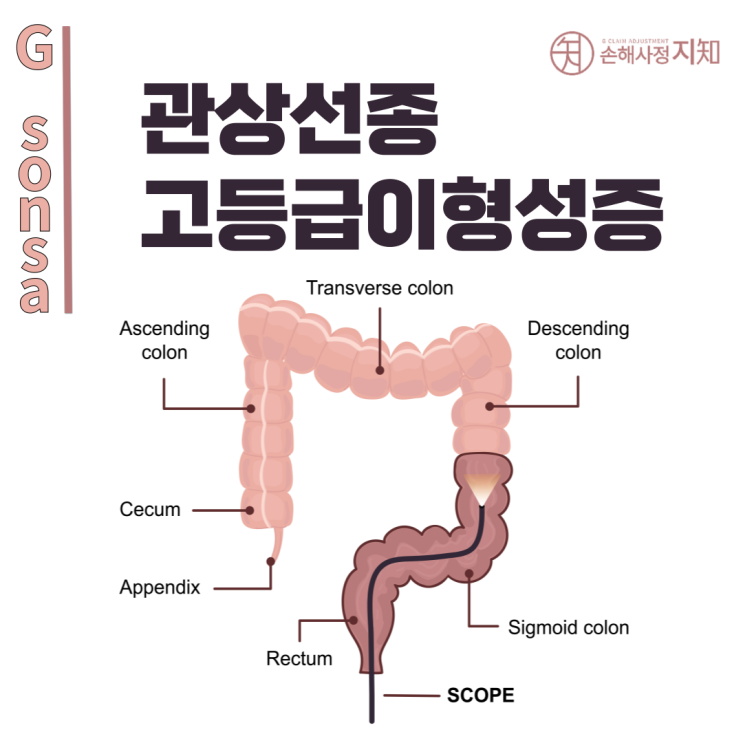  관상선종(Tubular Adenoma) 진단 후 보험금, 남양주에서 해결하는 법