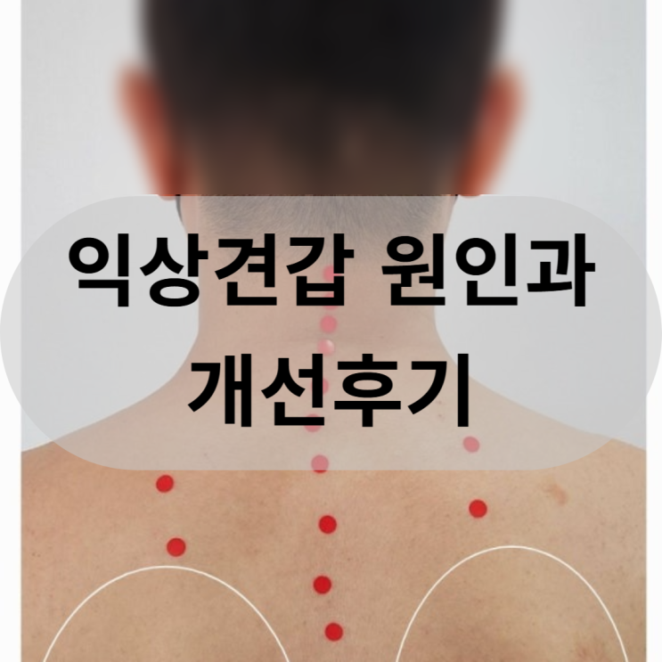  [동래 온천동 체형교정] 익상견갑 원인과 개선후기