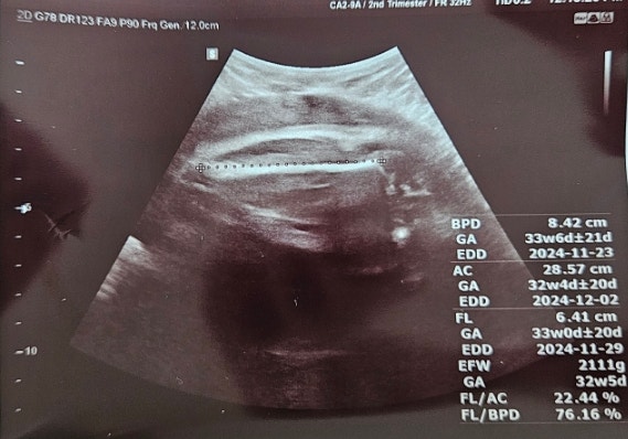  [임신검사] 32주 정기검진 받았어요!(태아 크기, 몸무게)