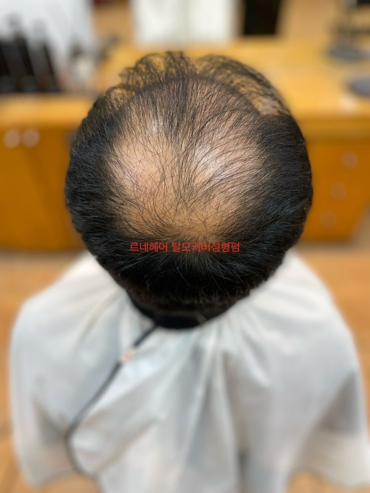  아빠의 도전! 당당해지고싶어요 단한가닥이라도내머리카락으로 펌을. 부산사상르네시떼미용실 / 북구삼락하단만덕엄궁김해다대감전주례당감서면부전연산양정수영망미토곡안락동래명륜장전금정민락청사포