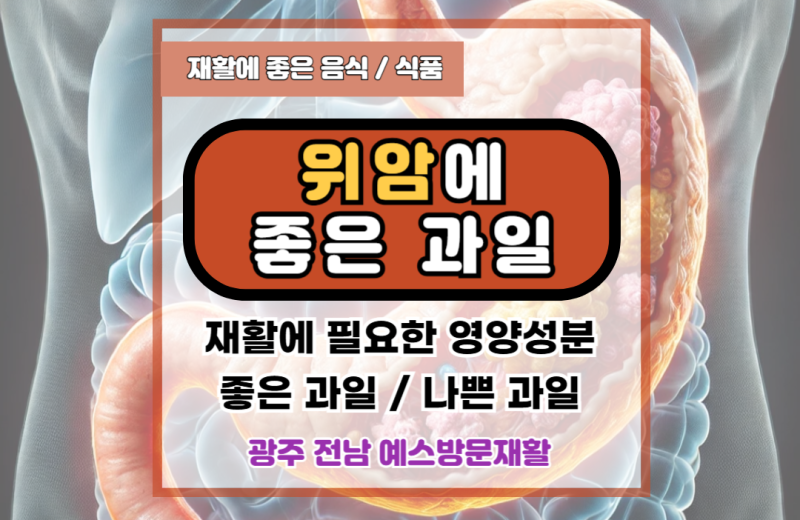 위암에 좋은 과일, 나쁜 안 좋은 과일은?