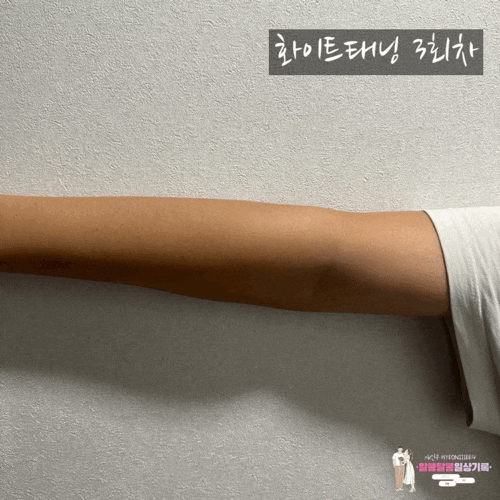  화이트 태닝 10회 받으면 연예인처럼 하얘질까?