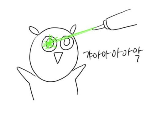대전 밝은누리안과 스마일라식 검안, 수술당일 ~ 1일차 생생 후기