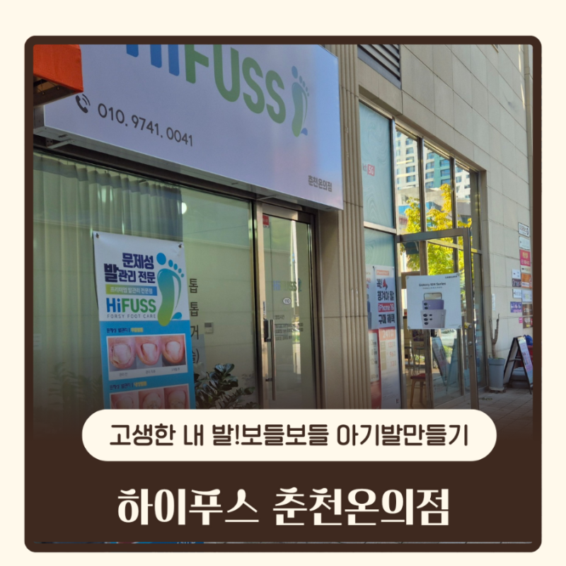 (춘천온의동)하이푸스 춘천온의점-춘천내성발톱, 티눈, 사마귀 관리