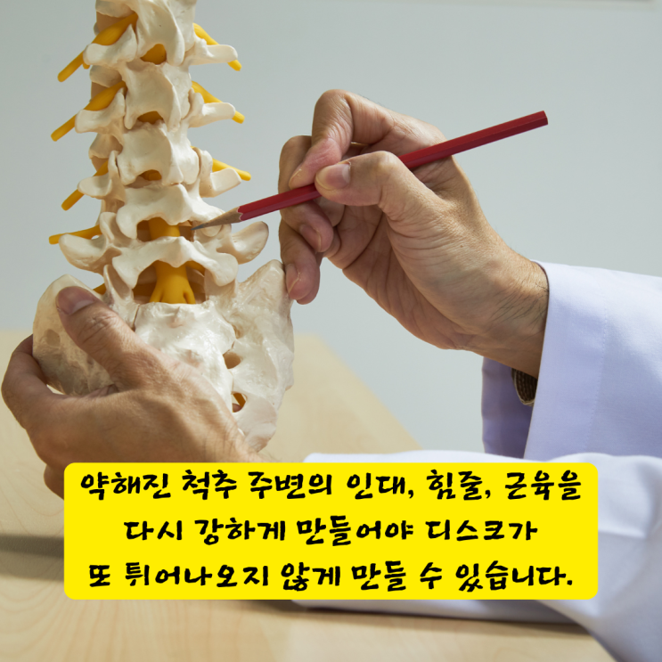  연산동신경외과, 허리디스크 수술? 알아두면 후회 없는 비수술 치료법