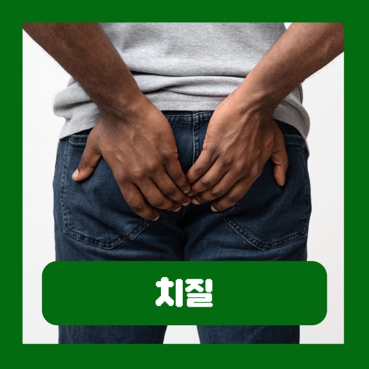  치질 치핵 치루 치열 차이 항문질환 종류 원인 초기증상