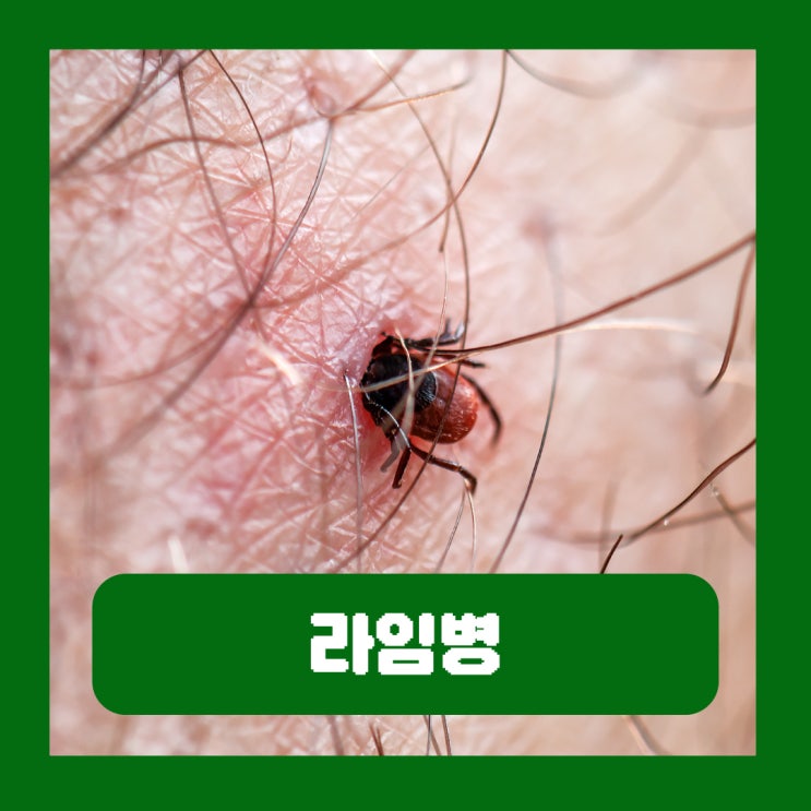  라임병전염 홍반 증상 진드기 원인 강아지 치료 완치