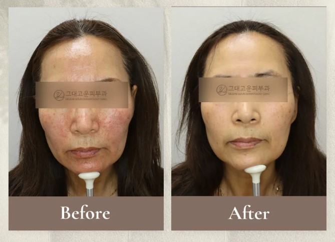 해운대센텀피부과 알아보다 지치셨나요? 해운대센텀피부과 알아보다 지치셨나요?