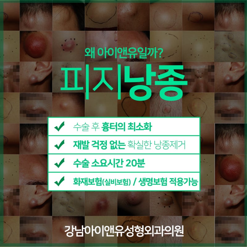 전주 피지낭종, 지방종 차이와 원인 그리고 수술법은?