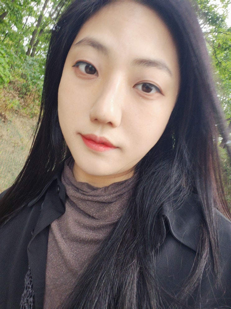  서울대입구역 피부과 고주파리프팅 덴서티하이 팔자주름 효과 솔직후기