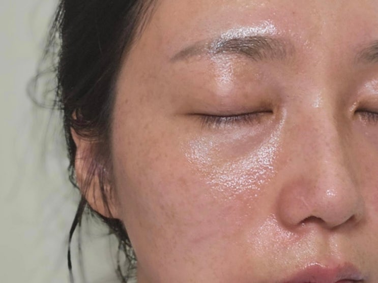  이천 마장면 피부관리 도도한여우에서 진정관리 받았어요