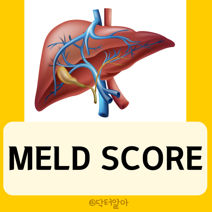  MELD 점수(MELD score)의 정의, 구성, 해석, 한계, 보완
