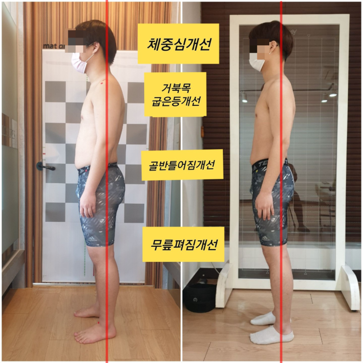  [부산 거제동 필라테스] LV체형분석운동센터 굽은등 교정 비포에프터 후기