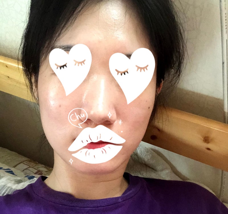 글루타치온 백옥주사10회 내돈내산 후기 (안하얘짐ㅎ 효과x, 주기)