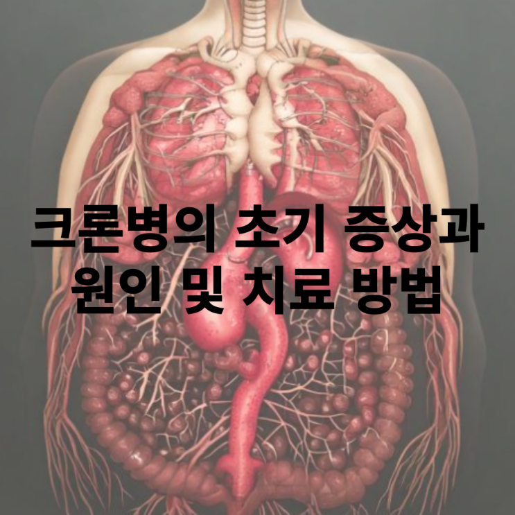  크론병의 초기 증상과 원인은 무엇인가?