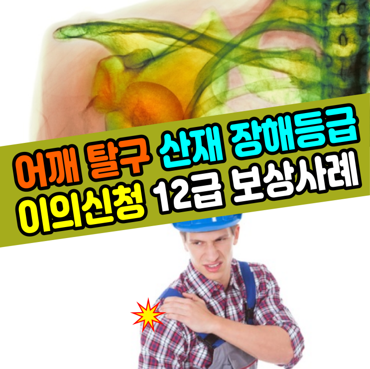  [부산 산재 노무사] 어깨 탈구 장해등급 이의신청(재심사) 12급 상향 보상사례