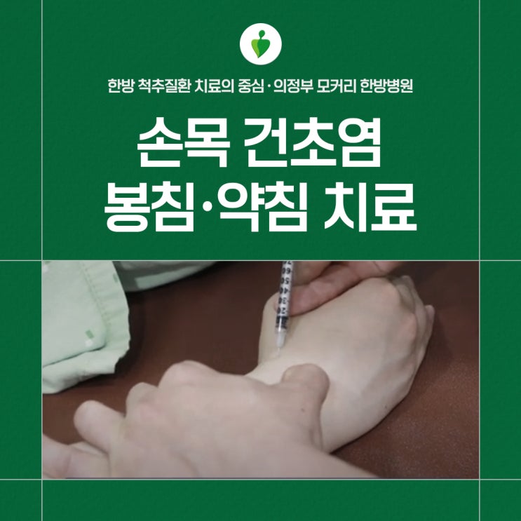  용현동 고산동 손목건초염(드퀘르벵) 치료에 좋은 봉침, 약침 | 모커리한방병원