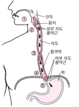 역류 및 되새김