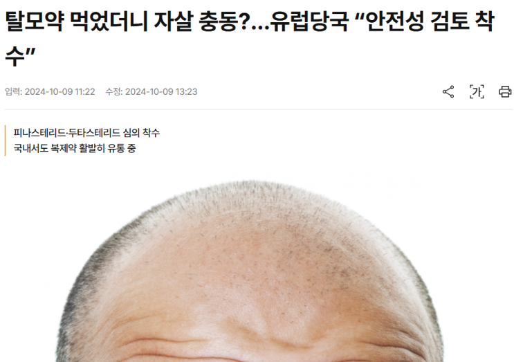  유럽의 탈모약 부작용 안전성 검토 착수에 대해