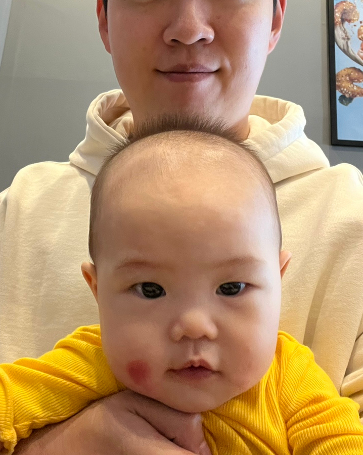  아토피 있는 아이 첫 초기 이유식 만들기 육아일기