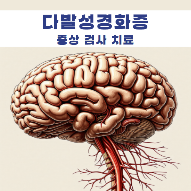 다발성경화증 초기 후기 증상 진단검사 치료 방법 약 치료제
