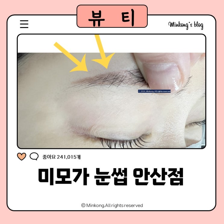  미모가눈썹 안산중앙점 - 고잔동 자연눈썹 속눈썹펌 동시관리 가능
