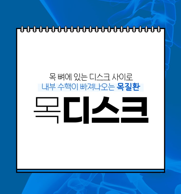 화곡동정형외과 두통까지 유발하는 목디스크 초기증상 빠른치료법