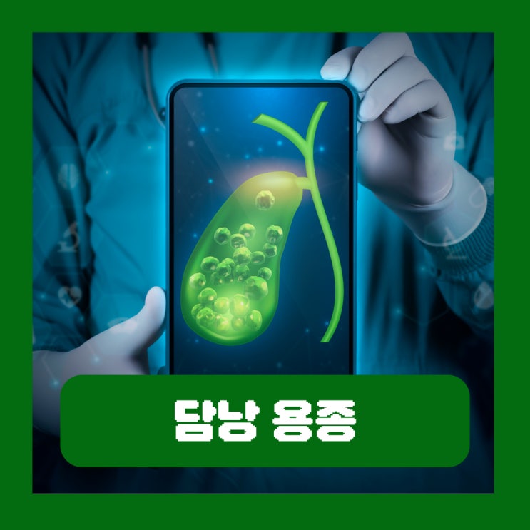  담낭 용종 여러개 다발성 원인 크기 3mm 1cm 제거 수술 치료