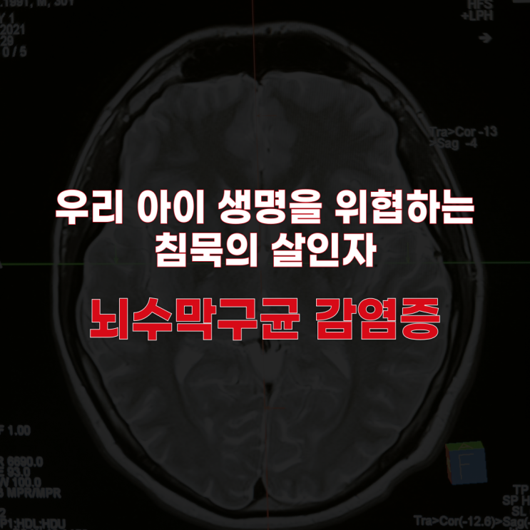  뇌수막구균 감염증: 초기 증상부터 예방 백신까지 꼭 알아야 할 필수 정보!