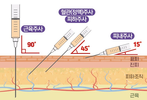 IV IM SC ID 정맥주사 근육주사 피하주사 피내주사 간호 수액용량계산 수액주입속도 주사부위 각도 주의사항 skin test ...