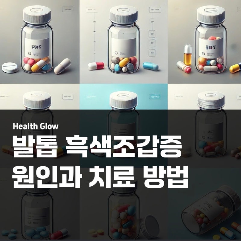 발톱 흑색조갑증 원인과 치료 방법