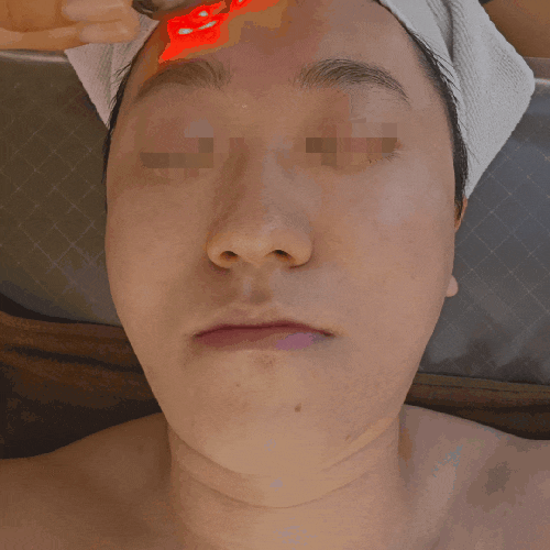  양산 피부관리 잘하는 뷰티인에스테틱 기본관리로 홍조 탈출!