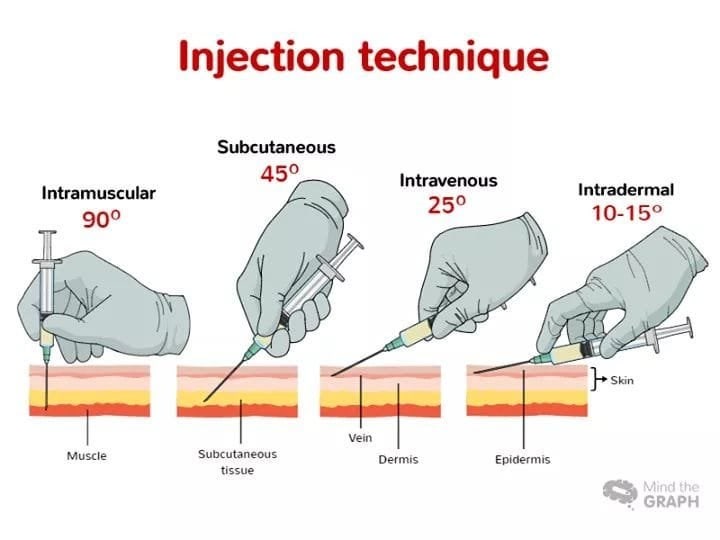 IV IM SC ID 정맥주사 근육주사 피하주사 피내주사 간호 수액용량계산 수액주입속도 주사부위 각도 주의사항 skin test ...