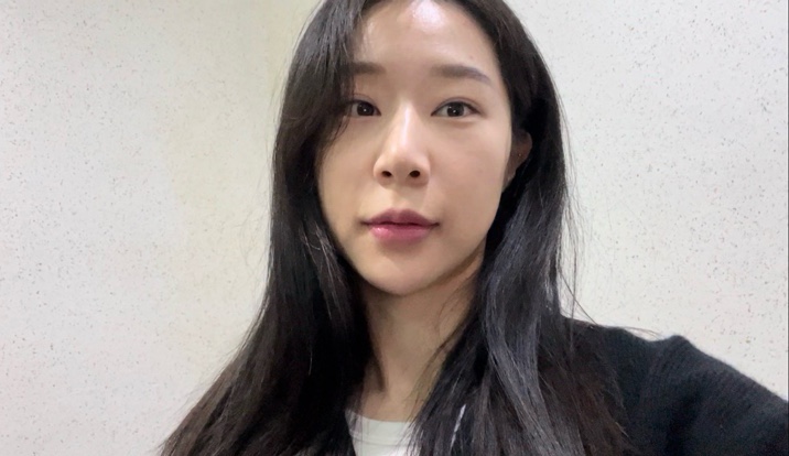  입술필러 한 달~한 달 반 후기(뀨입술로 시작-붓기 빠진 후 만족도 200%)