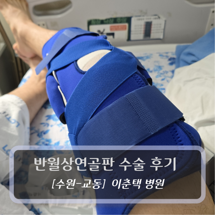  [수원 - 교동, 이춘택병원] 반월상연골판 수술 후기 (허준혁 부원장 - 봉합술)