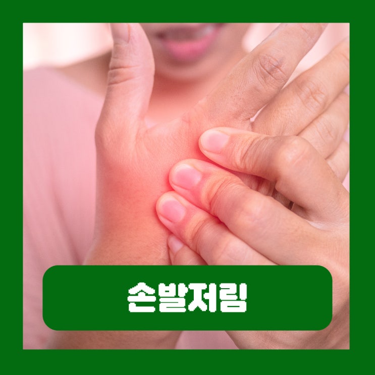  손발저림 원인 말초신경병증 증상 검사 치료 혈액순환 문제