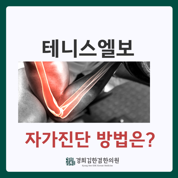  팔꿈치 통증이 계속되면 테니스엘보? 또다른 증상으로 알 수 있는 자가진단은?