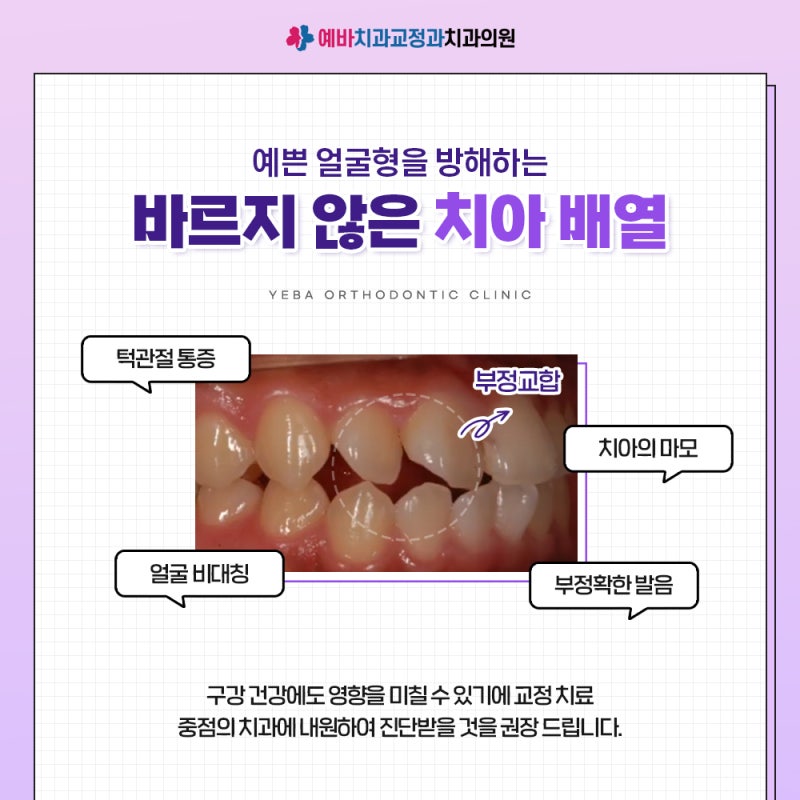 부산교정치과가 중요한 이유