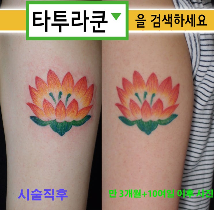  시술 약 100일후 발색비교/영화타투/나나/손그림타투/연꽃문신/색연필타투 [홍대 타투라쿤]