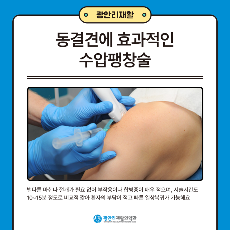  부산 수영구 정형외과 ) 오십견에 효과적인 수압팽창술