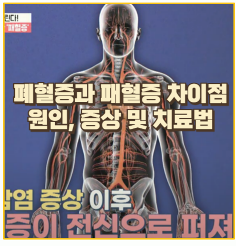  폐혈증과 패혈증 초기 증상부터 예방법까지 경험에서 얻은 생생한 정보
