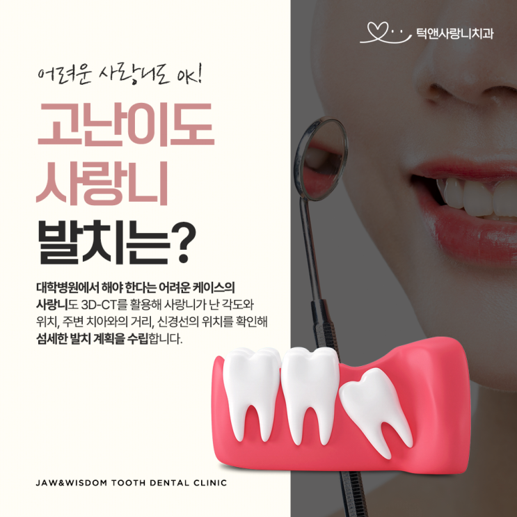  두정동치과 드라이소켓에 대해