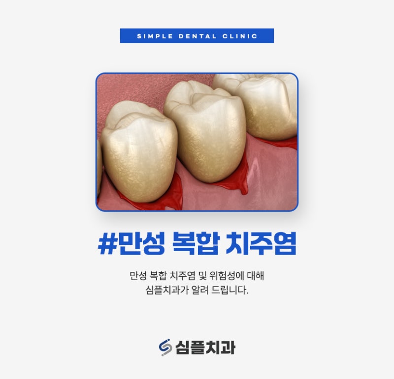 만성복합치주염을 쉽게 생각해서는 안됩니다.