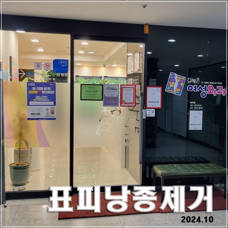  표피낭종제거 : 천안 김혜은여성외과 레이저 제거