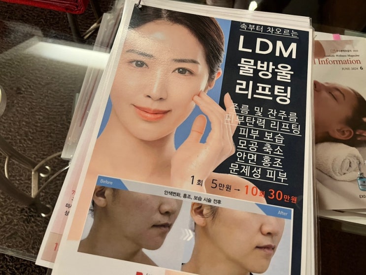  결혼 준비 중! 세레니끄 목동점 LDM 물방울 관리 후기